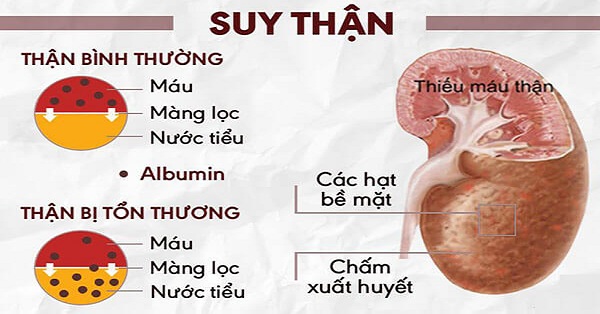 Suy than An tu hinh khong chinh thuc